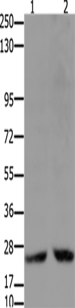 Anti-Human/Mouse/Rat HMGB2 Antibody - ABMIUM