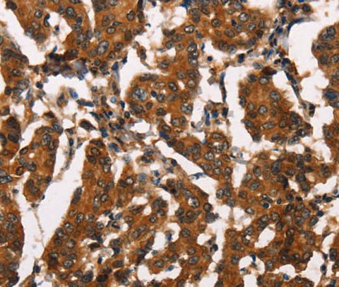 Anti-Human/Mouse/Rat ATRN Antibody - ABMIUM