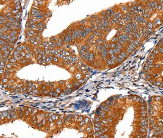 Anti-Human/Mouse/Rat FGFR1 Antibody