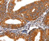 Anti-Human/Mouse/Rat FGFR1 Antibody - ABMIUM