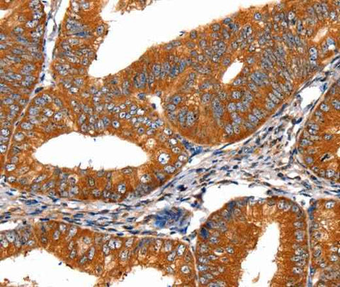 Anti-Human/Mouse/Rat FGFR1 Antibody