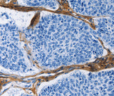 Anti-Human/Mouse/Rat COL3A1 Antibody - ABMIUM