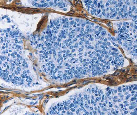 Anti-Human/Mouse/Rat COL3A1 Antibody
