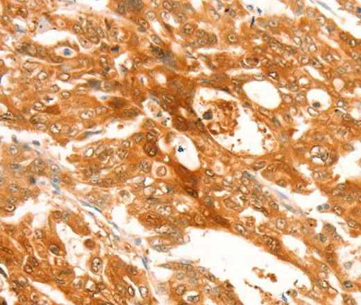 Anti-Human/Mouse/Rat TRPM7 Antibody