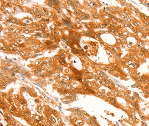 Anti-Human/Mouse/Rat TRPM7 Antibody - ABMIUM