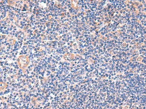 Immunohistochemistry of paraffin-embedded Human tonsil tissue using ZNF256 Polyclonal Antibody at dilution of 1:120(×200)
