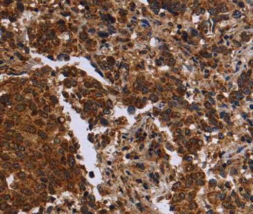 Anti-Human FMN2 Antibody