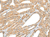 Anti-Human/Mouse/Rat CCL5 Antibody - ABMIUM