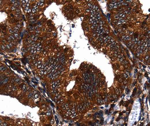 Anti-Human EGF Antibody