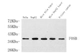 Western Blot analysis of various samples using FOSB Polyclonal Antibody at dilution of 1:1000.