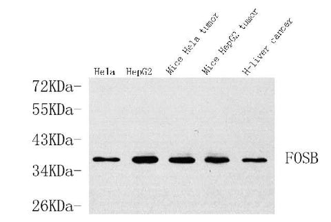 Western Blot analysis of various samples using FOSB Polyclonal Antibody at dilution of 1:1000.