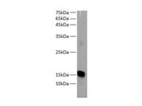 Western blot of Zebrafish whole lysates with anti-MB rabbit polyclonal antibody at dilution of 1:1000.