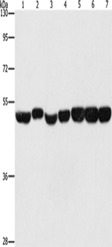 Anti-Human/Mouse/Rat ENO1 Antibody - ABMIUM