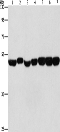 Anti-Human/Mouse/Rat ENO1 Antibody - ABMIUM