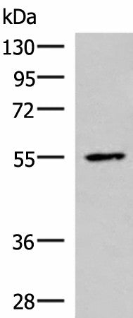 Western blot analysis of HepG2 cell lysate using ISM1 Polyclonal Antibody at dilution of 1:1000
