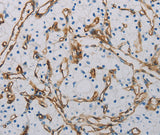 Anti-Human/Mouse CD31 Antibody - ABMIUM