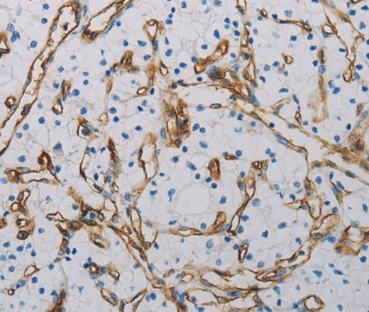 Anti-Human/Mouse CD31 Antibody - ABMIUM