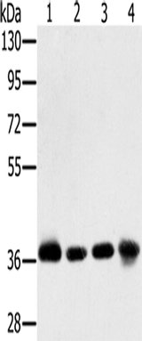 Anti-Human/Mouse/Rat PDLIM1 Antibody - ABMIUM