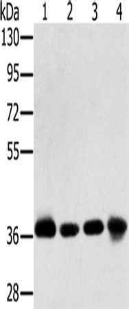 Anti-Human/Mouse/Rat PDLIM1 Antibody - ABMIUM