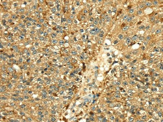 Anti-Human/Mouse/Rat CTSH Antibody - ABMIUM