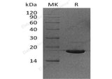 Recombinant Human UBE2V2/DDVIT1 Protein (His Tag) - ABMIUM