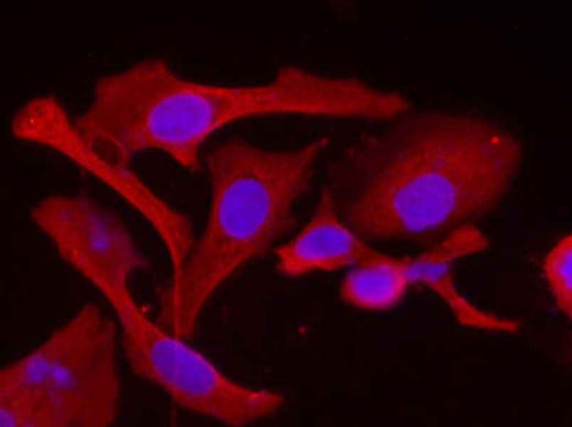 Anti-Human HSP-27 Antibody - ABMIUM