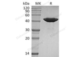Recombinant Human IDH1 Protein (R132H, C-8His) - ABMIUM