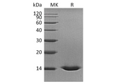 Recombinant Human Cystatin D Protein (His Tag) - ABMIUM