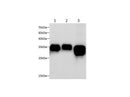 Anti-Human/Mouse/Rat Annexin A1 Antibody - ABMIUM
