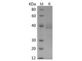 SDS-PAGE analysis of Human IL-12(p70) proteins, 2 μg/lane of Recombinant Human IL-12(p70) proteins was resolved with SDS-PAGE under reducing conditions, showing bands at 38 kDa.