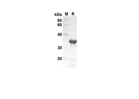 SDS-PAGE analysis of Human IL-10 proteins, 2 μg/lane of Recombinant Human IL-10 proteins was resolved with an SDS-PAGE under reducing conditions, showing bands at 35 kDa.