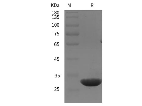 SDS-PAGE analysis of Rat CD146/MCAM proteins, 2 μg/lane of Recombinant Rat CD146/MCAM proteins was resolved with SDS-PAGE under reducing conditions, showing bands at 30 kDa.