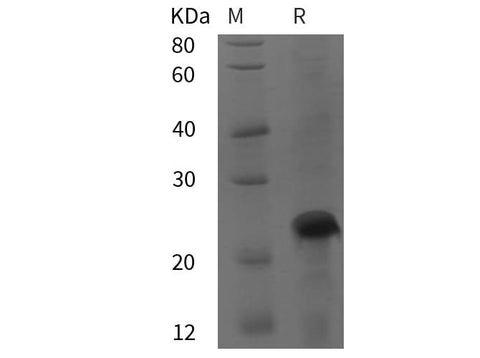 SDS-PAGE analysis of Rat GPRC6A proteins, 2 μg/lane of Recombinant Rat GPRC6A proteins was resolved with SDS-PAGE under reducing conditions, showing bands at 25 kDa.