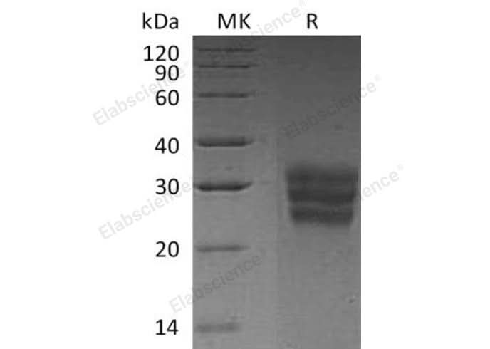 Recombinant Human FLT3LG/Flt3 Ligand Protein (His Tag) - ABMIUM