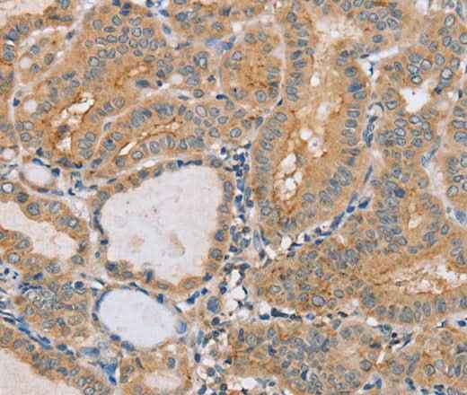 Anti-Human/Mouse PTPN4 Antibody