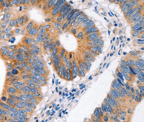 Anti-Human/Mouse MC1R Antibody - ABMIUM