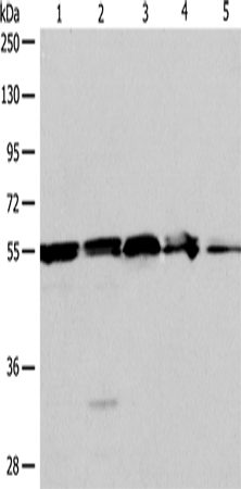 Anti-Human/Mouse/Rat NAMPT Antibody - ABMIUM