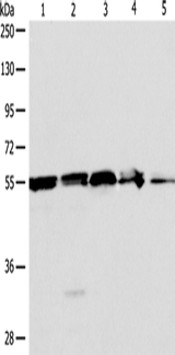 Anti-Human/Mouse/Rat NAMPT Antibody - ABMIUM