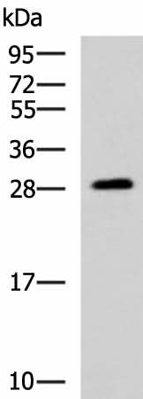 Western blot analysis of Human fetal brain tissue lysate using PAFAH1B3 Polyclonal Antibody at dilution of 1:1000
