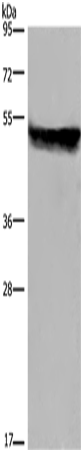Anti-Human/Mouse/Rat CYP2E1 Antibody - ABMIUM