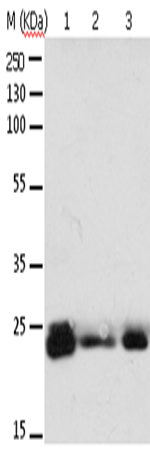 Anti-Human/Mouse/Rat RAB6A Antibody - ABMIUM