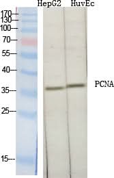 Western Blot analysis of COS-7 cells using Proliferating Cell Nuclear Antigen Polyclonal Antibody at dilution of 1:2000.