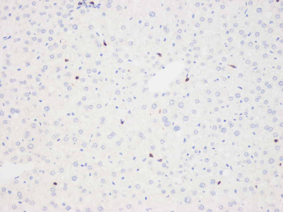 Immunohistochemistry analysis of paraffin-embedded mouse liver using THY1 Polyclonal Antibody at dilution of 1:500.