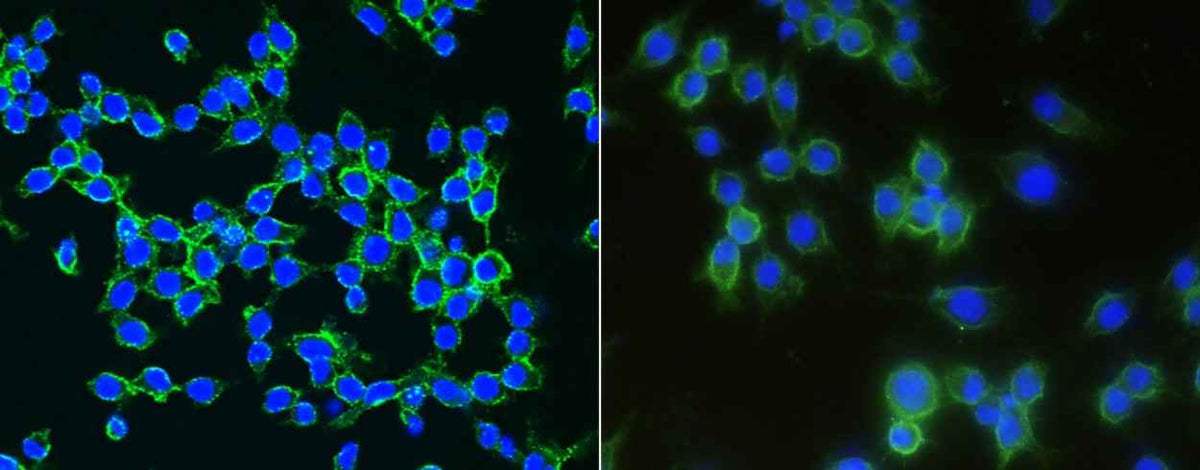Anti-Mouse LDLR Antibody [B435] - ABMIUM