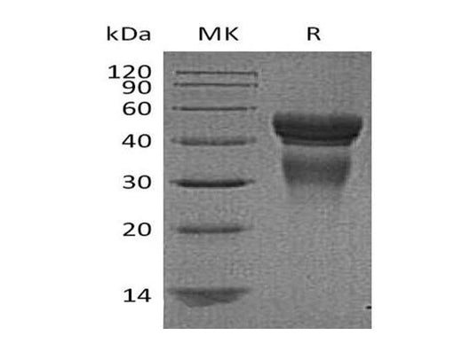Recombinant Human Interleukin-12/IL-12 Protein - ABMIUM