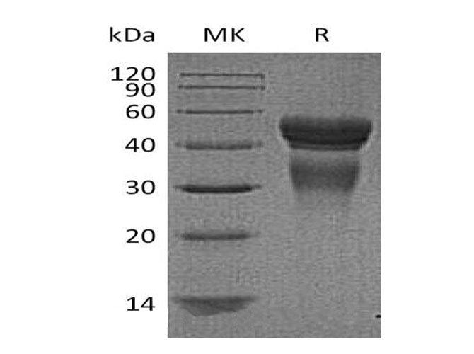 Recombinant Human Interleukin-12/IL-12 Protein - ABMIUM