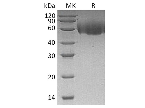 Recombinant Human CD155/PVR/NECL5 Protein (His Tag) - ABMIUM