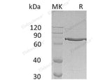 Recombinant Human Cyr61/CCN1 Protein (Fc Tag) - ABMIUM
