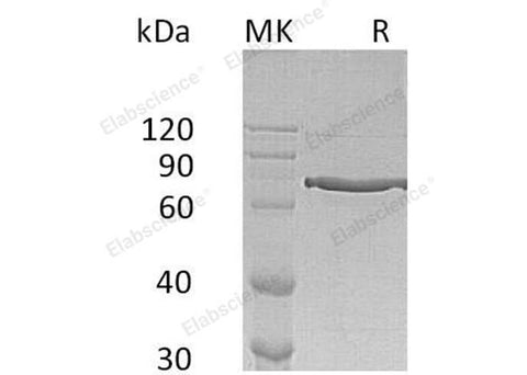 Recombinant Human Cyr61/CCN1 Protein (Fc Tag) - ABMIUM
