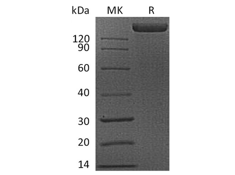 Recombinant Human FLT1 Protein (Fc Tag) - ABMIUM